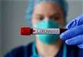 Coronavirus West Berkshire: latest confirmed cases as of Sunday, October 24