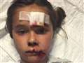 Girl thrown and kicked by a pony at Newbury Racecourse 