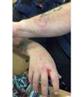 Agony of have-a-go motorist bitten in M4 attack