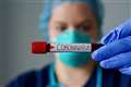 Coronavirus West Berkshire: Latest number of confirmed cases (April 27)