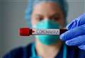 Coronavirus West Berkshire: latest confirmed cases as of December 30