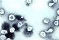 Coronavirus Basingstoke and Deane: Number of deaths involving Covid-19 registered to May 15, 2021. 