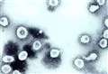 Coronavirus Basingstoke and Deane: Number of deaths involving Covid-19 registered to June 19, 2021