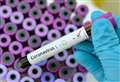 First case of Omicron found in West Berkshire 