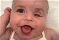 Baby in battle with rare eye cancer