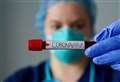Coronavirus West Berkshire: latest confirmed cases as of Sunday, September 26