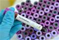 Scientists warn of new Covid variant with 'horrific' mutations 