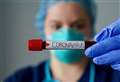 Coronavirus West Berkshire: latest confirmed cases as of March 30