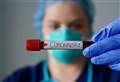 Coronavirus West Berkshire: confirmed cases as of October 9, 2021