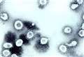 POLL: Have you had Covid-19?