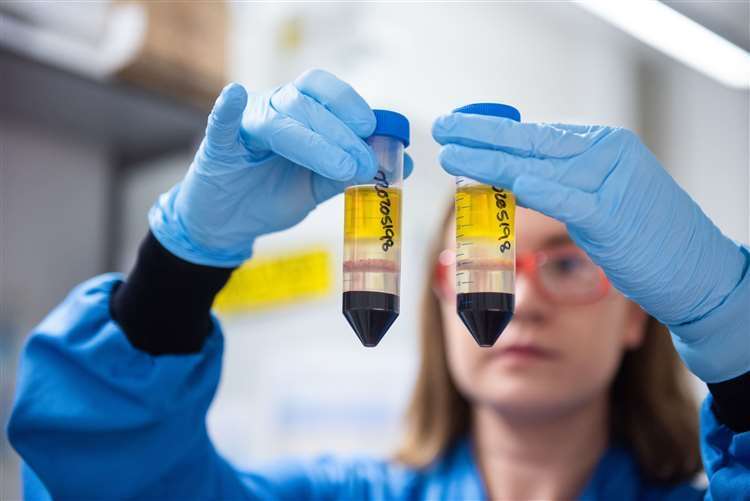 The UK has ordered 100 million doses of the Oxford/AstraZeneca vaccine (John Cairns/University of Oxford/PA)