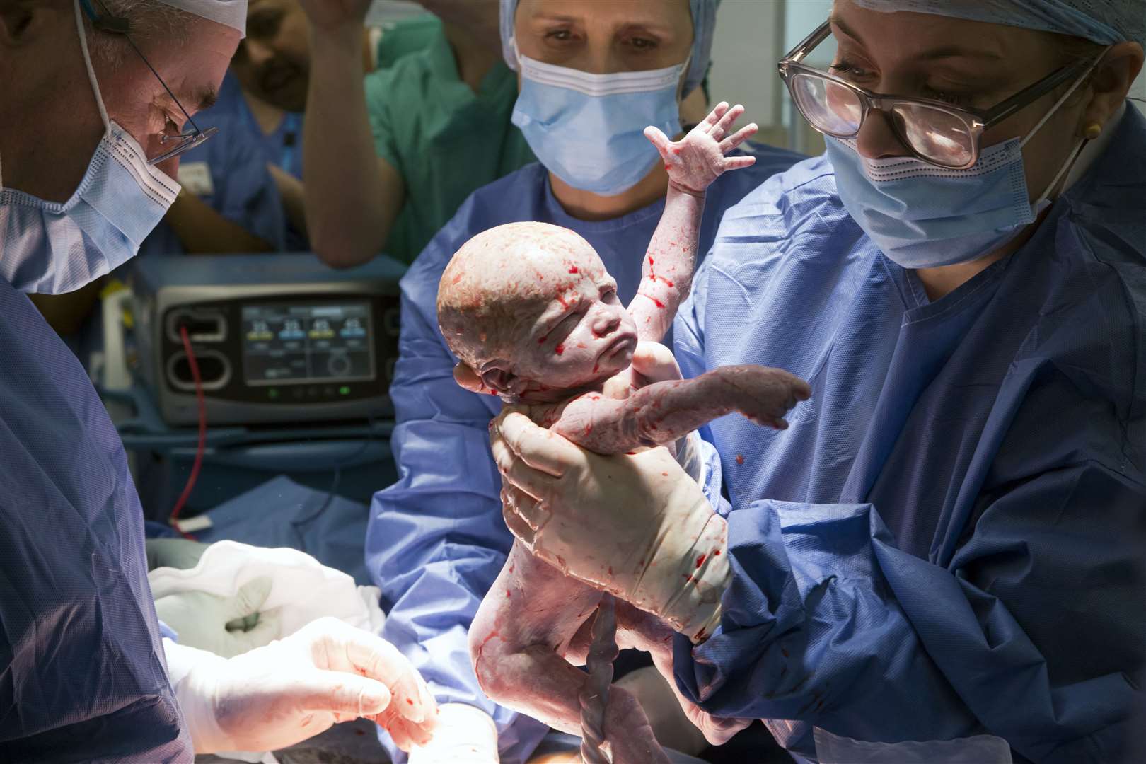 Amy was born by Caesarean section at Queen Charlotte’s and Chelsea Hospital in London in February (Womb Transplant UK/PA)