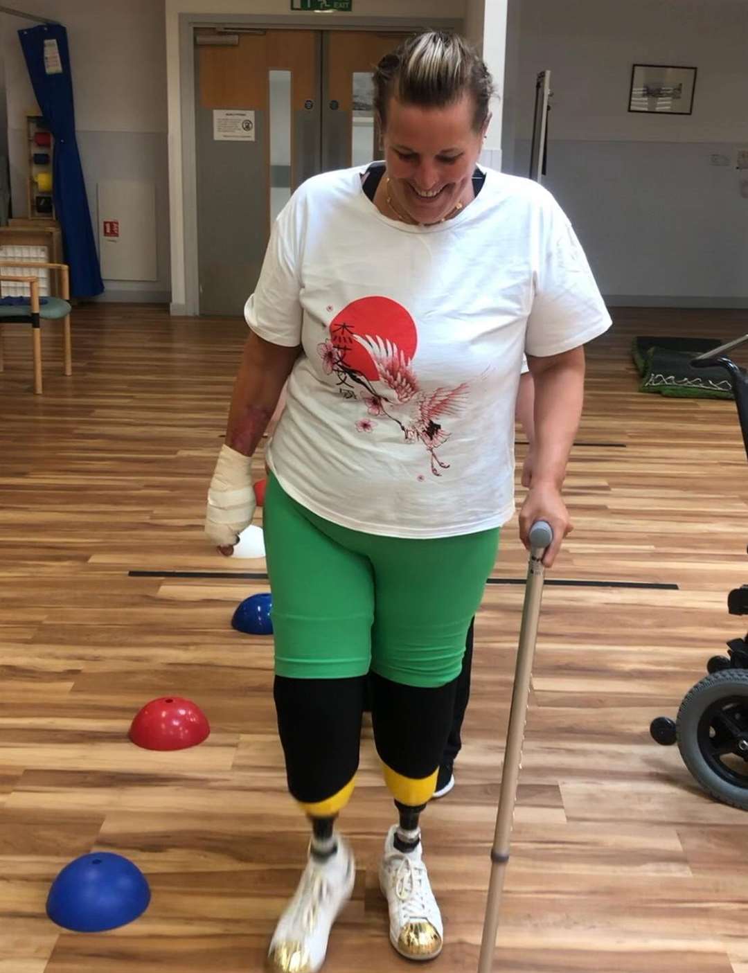 Beth during her physio
